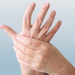 Casos-de-artritis-reumatoide-aumentaron-en-el-mundo-en-los-ultimos-30-anos