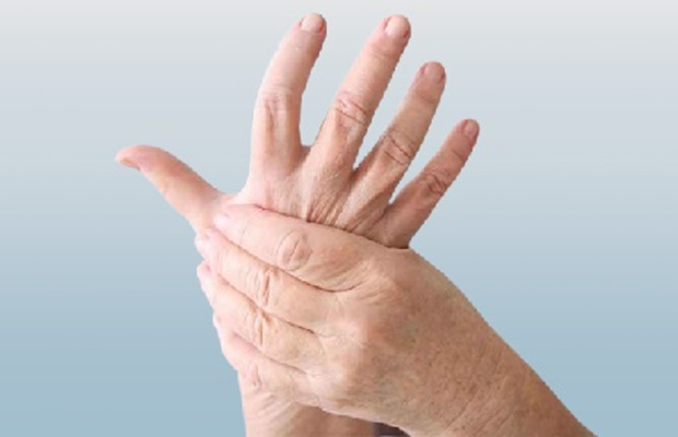 Casos-de-artritis-reumatoide-aumentaron-en-el-mundo-en-los-ultimos-30-anos